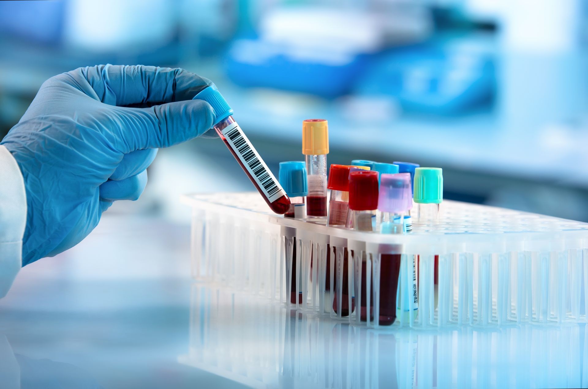 Diagnostic Tests 